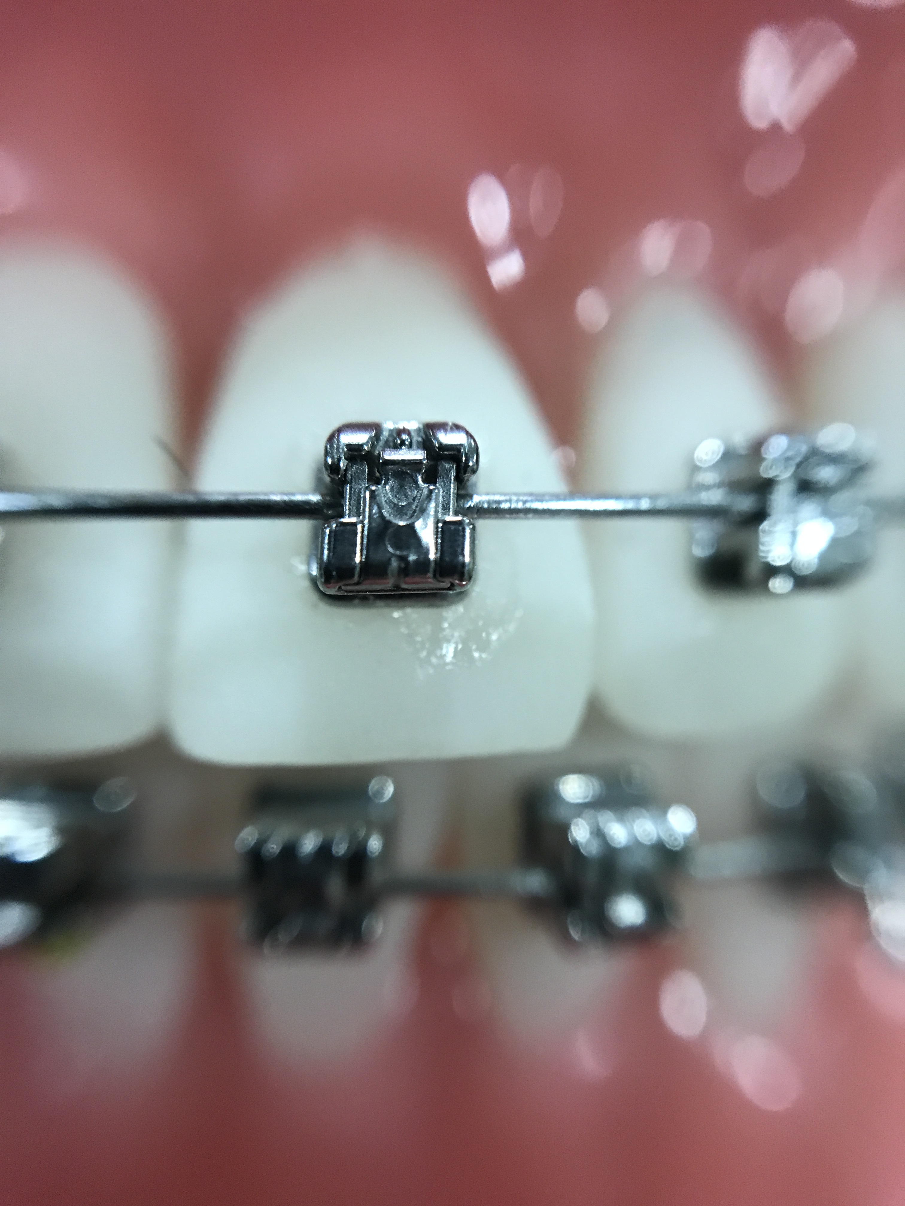 Ortodoncia y alineación dental