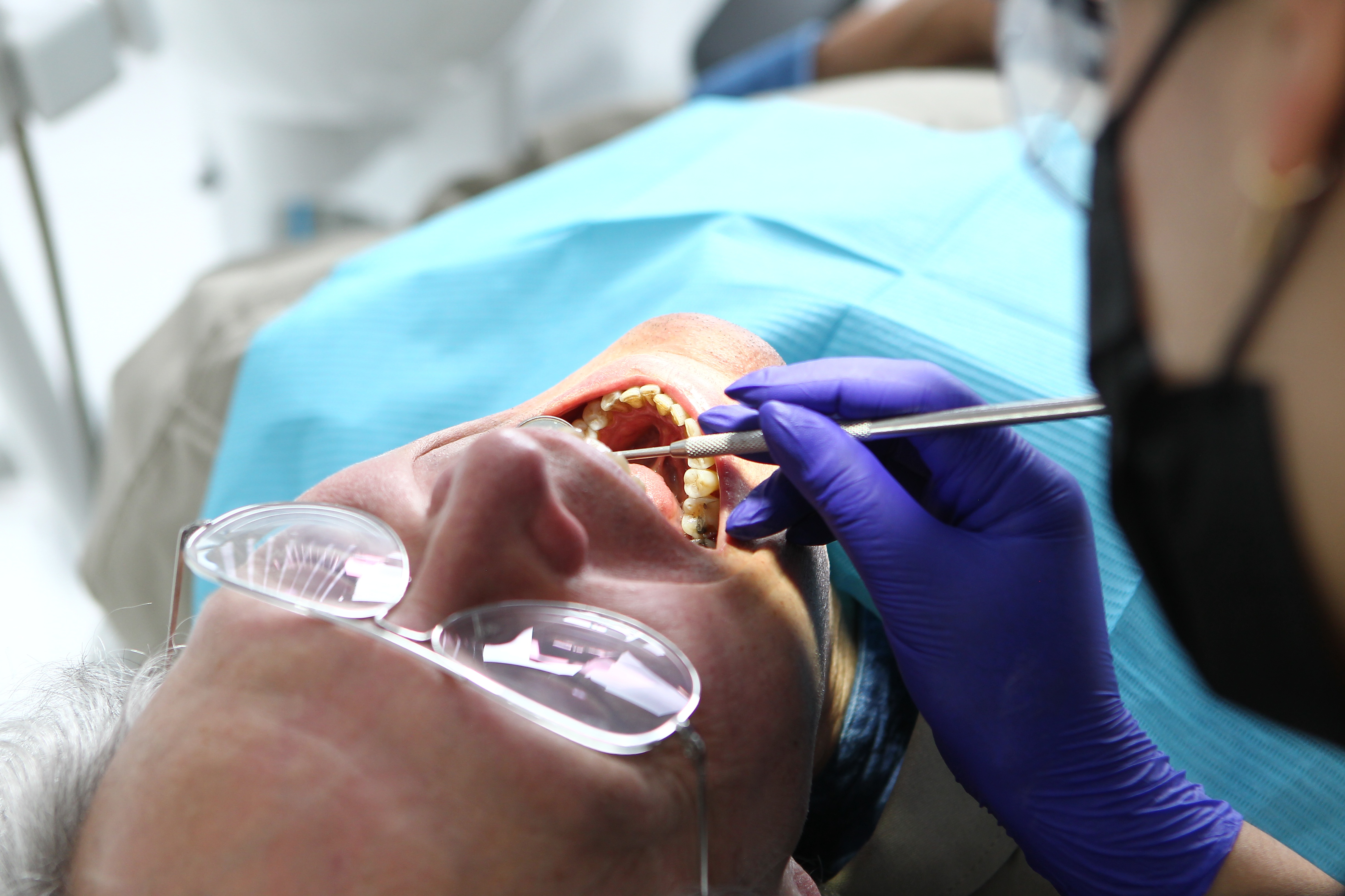 Limpieza dental profesional